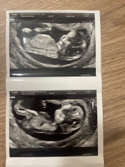 Gender??