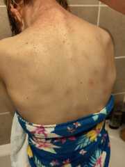 Any ideas what this could be? Drs baffled