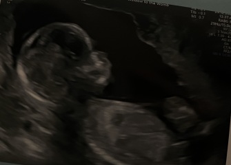 Due June 2025 pt2!