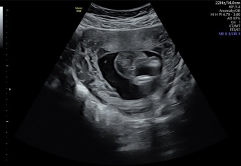 Any Sonographers out there?
