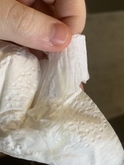 Is this mucus plug? TMI PIC WARNING