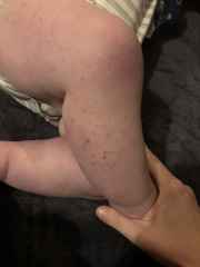 The November 2023-ish babies - the further adventures of…