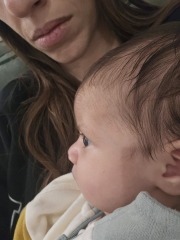 Worried for chromosome syndromes