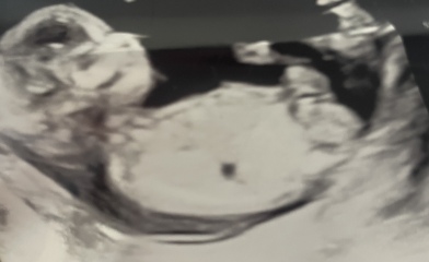 Any gender guesses for fun?