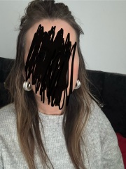 Has bleach ruined my hair ? Pics included