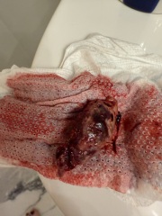 TW* gross picture. Period Help worried