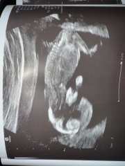 Boy or girl