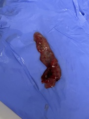 Did I just Miscarry ?**CONTAINS SENSITIVE IMAGES**