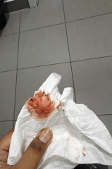 New with TTC * Warning blood photo
