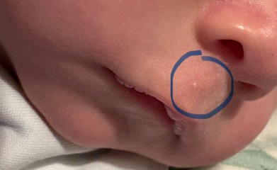 MIL kissed baby on the head with a coldsore