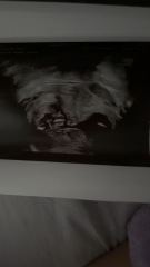 Nub theory guesses?