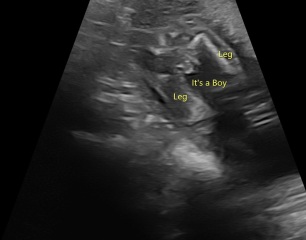 Gender scan