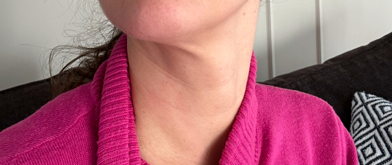 Saggy Neck Skin