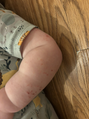 The November 2023-ish babies - the further adventures of…