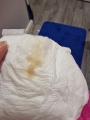 Pregnancy discharge
