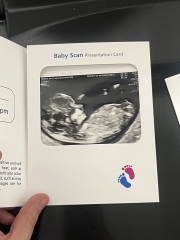 Baby gender nub or skull theory