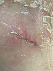Does this look like it’s healing okay?