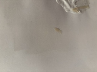 What is this discharge? *Pic*