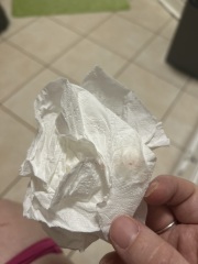 Little bit of bleeding at 37+6 weeks