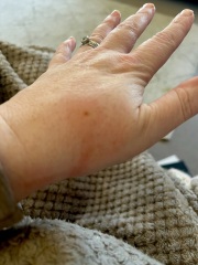 Identify my bites!