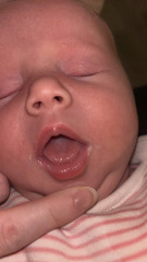Tongue tie?