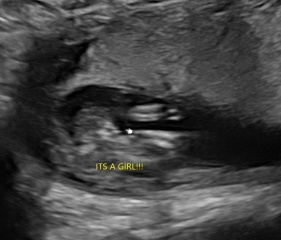 How accurate is an early gender scan at 16 weeks?