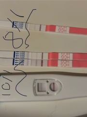 Line progression - so anxious