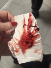 Heavy bleeding 6 weeks - pic attached