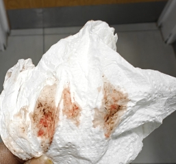 New with TTC * Warning blood photo