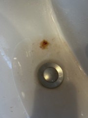 Is this popcorn or not? (Grim picture)