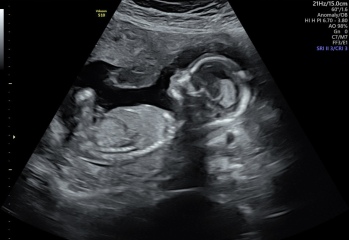 Any Sonographers out there?