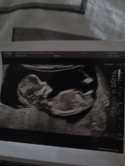 Going down a rabbit hole with nub theory (yes I know I am crazy) - Is this definitely a boy!