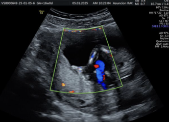 Gender Scan - Potty Shots!