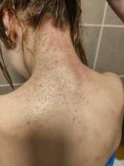 Any ideas what this could be? Drs baffled