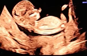 12+3, any gender guesses?🩷💙