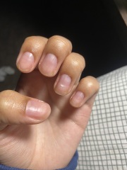 Nail lifting from bed after mani!!