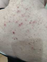 Any ideas what this could be? Drs baffled