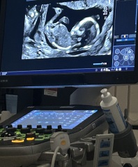 Boy or girl predictions from scan?