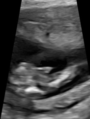 Definitely a boy?