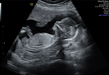 Any Sonographers out there?