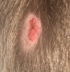 Suspicious nodule on 4y/o sons scalp