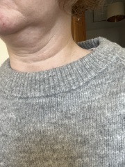 Help! My neck looks terrible! (Pics)