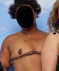 Friend wants top surgery