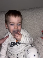 Head bump with lump and bruise