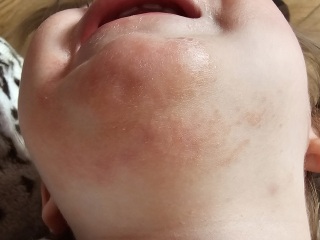 Has anyone had or seen anything like this?