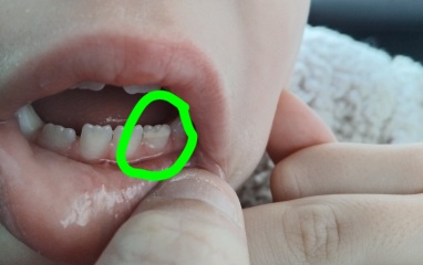 Whats wrong with DS tooth?! (With pic)