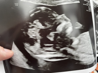 Girl or boy