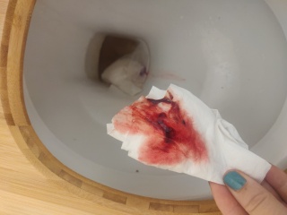 Implantation bleeding or early light period?!