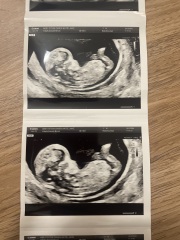 Gender??