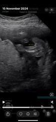 Potty shot! Boy or girl ?!